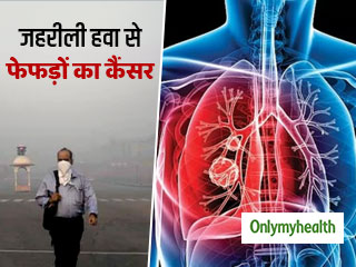 दिल्ली की जहरीली हवा से 28 साल की लड़की को हुआ फेफड़ों का कैंसर, डॉक्टर ने बताई ये वजह 